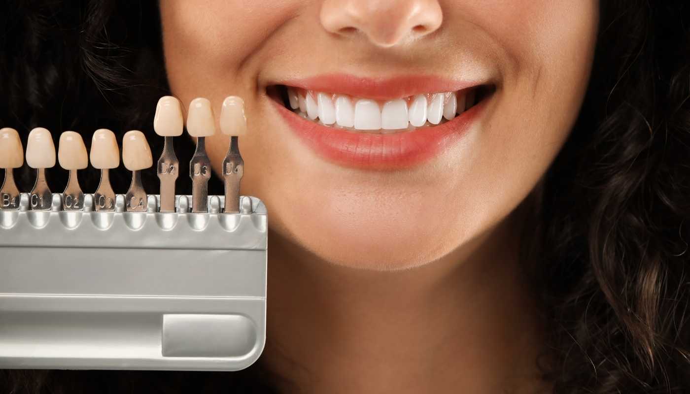Ventajas y Desventajas de las Carillas Dentales