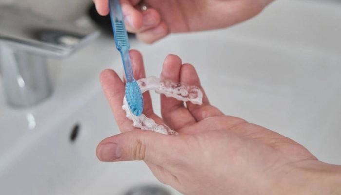 ¿Cómo Limpiar una Férula Dental y Mantenerla en Buen Estado?